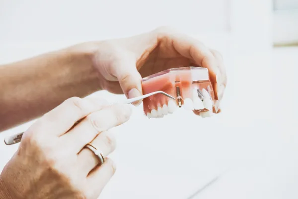 Jak długo średnio trwa ból zęba po wypełnieniu?